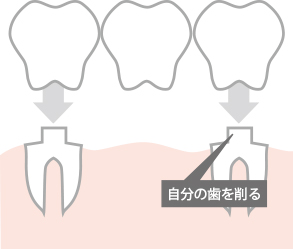 ブリッジ