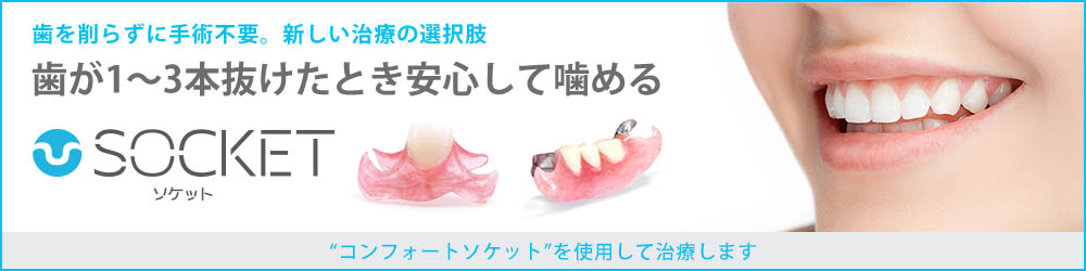 歯が1〜3本抜けたとき安心して噛めるソケット