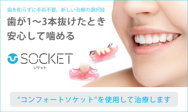 歯が1〜3本抜けたとき安心して噛めるソケット